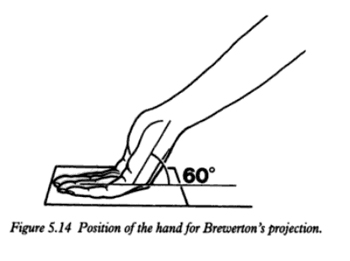 File:Brewerton2.jpg