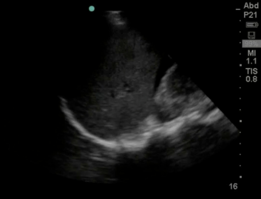 File:Free fluid 2.png