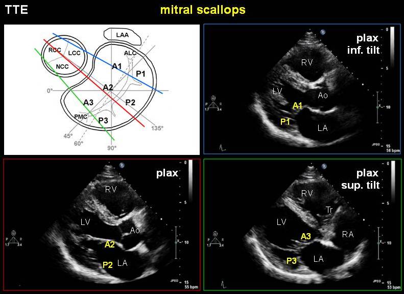 File:MV anatomy PSL.jpg