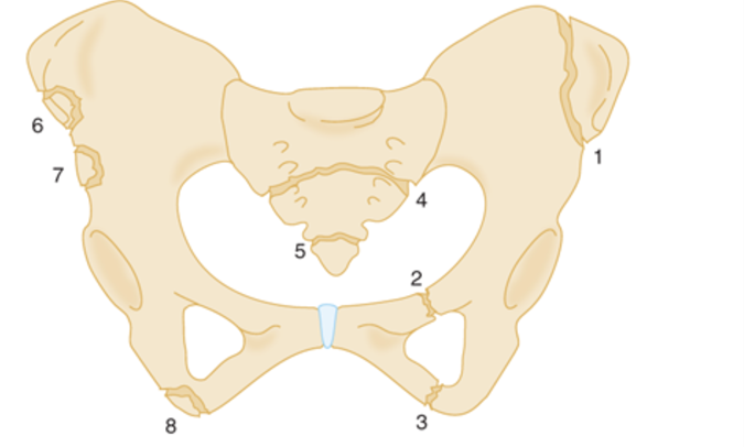 File:PelvicAvulsionFx.png