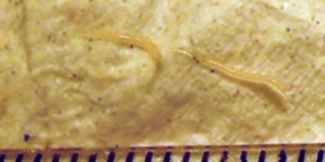 File:Pinworm.jpg
