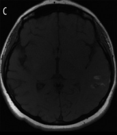 File:T1 Brain.png