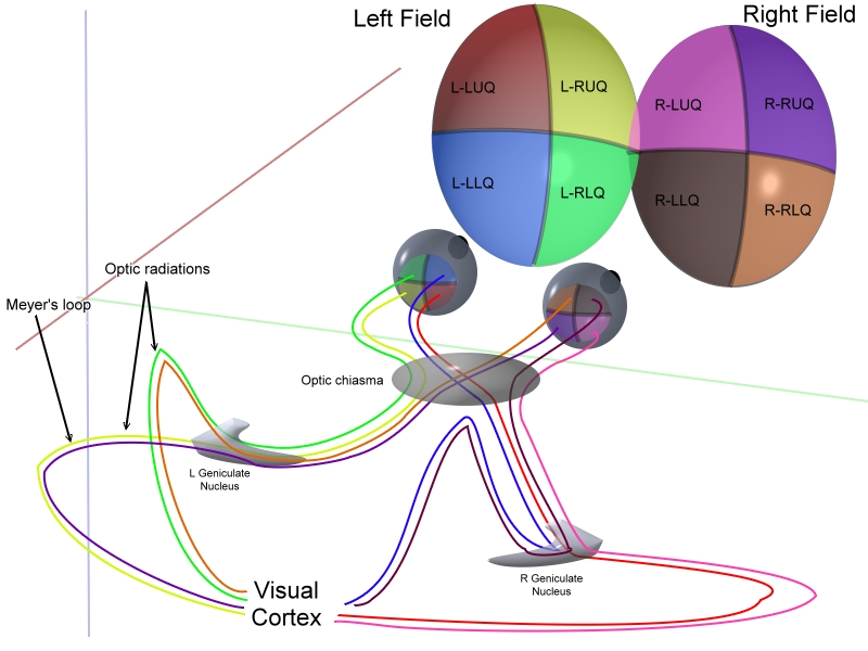 File:Visual field defects.jpg